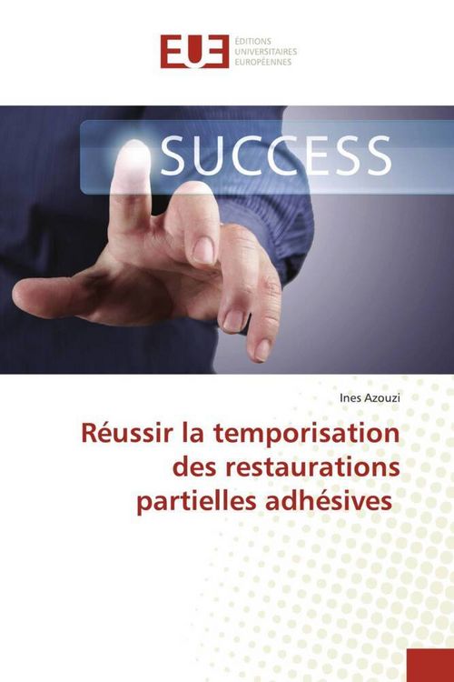 Produktbild: R&eacute;ussir la temporisation des restaurations partielles adh&eacute;sives