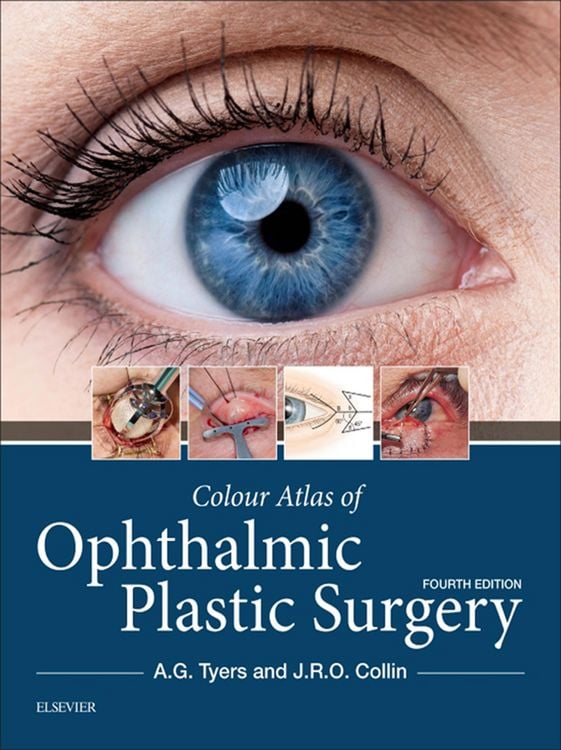 Produktbild: Colour Atlas of Ophthalmic Plastic Surgery E-Book