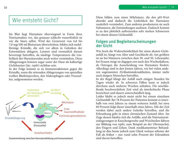 Produktbild: Die richtige Ern&auml;hrung bei Gicht