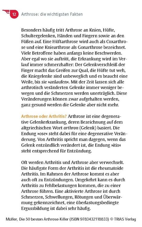 Produktbild: Die 50 besten Arthrose-Killer