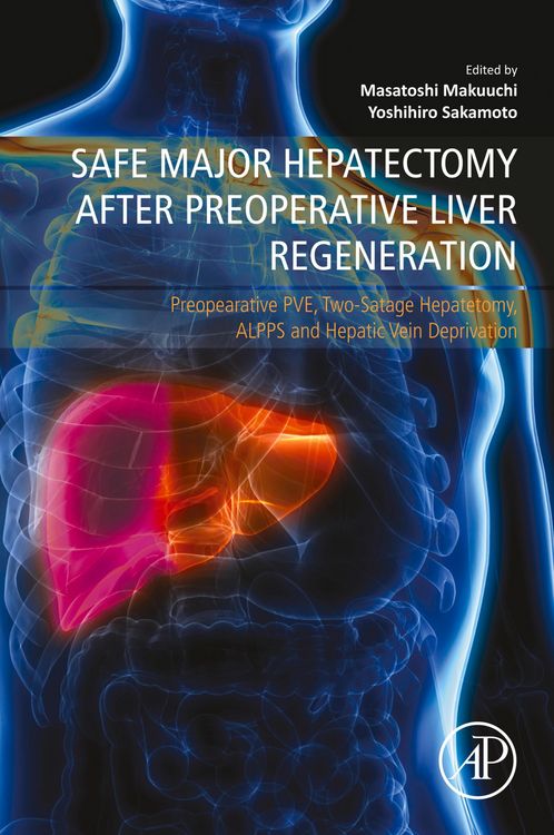 Produktbild: Safe Major Hepatectomy after Preoperative Liver Regeneration