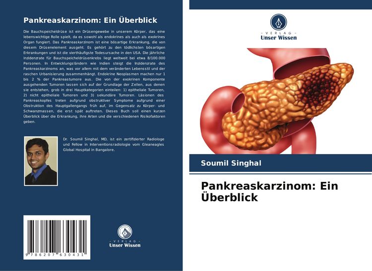 Produktbild: Pankreaskarzinom: Ein &Uuml;berblick