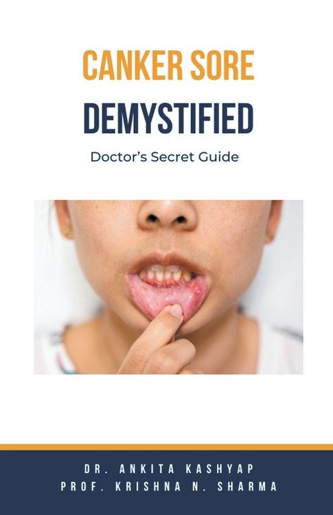 Produktbild: Canker Sore Demystified