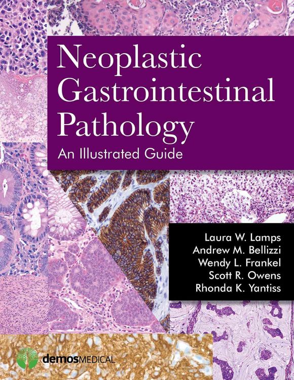 Produktbild: Neoplastic Gastrointestinal Pa