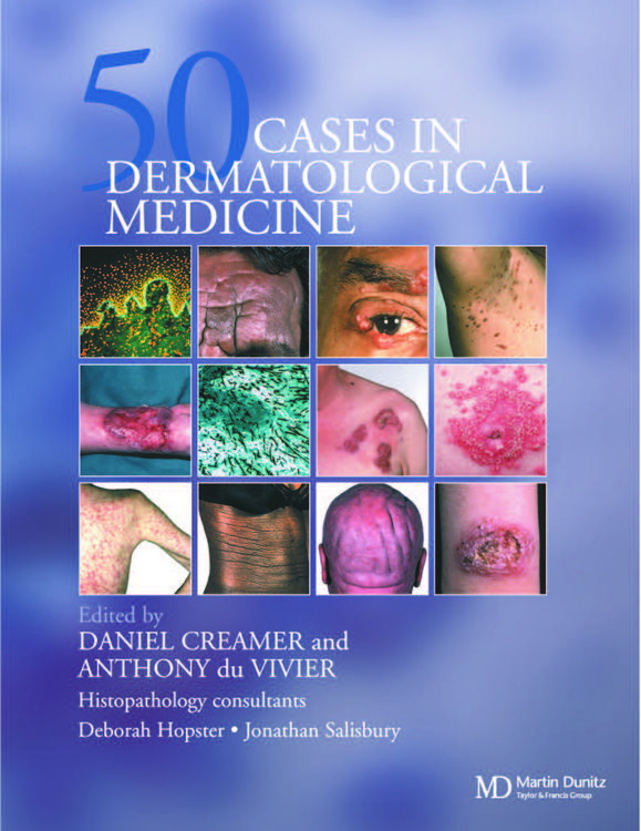 Produktbild: Fifty Dermatological Cases
