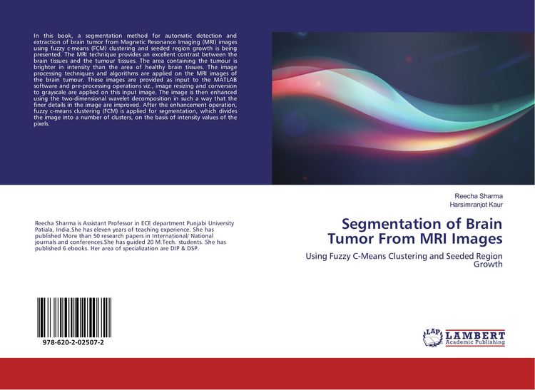 Produktbild: Segmentation of Brain Tumor From MRI Images