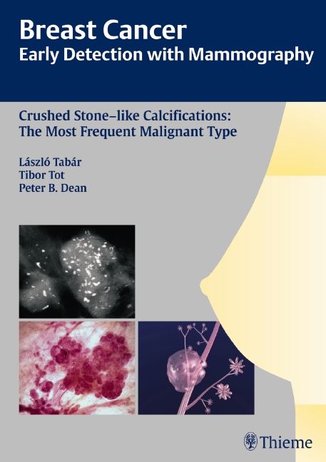 Produktbild: Breast Cancer: Early Detection with Mammography