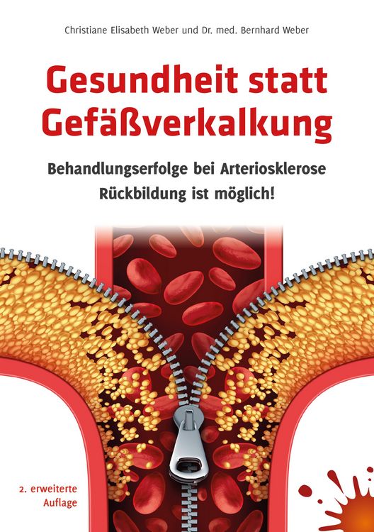Produktbild: Gesundheit statt Gef&auml;&szlig;verkalkung