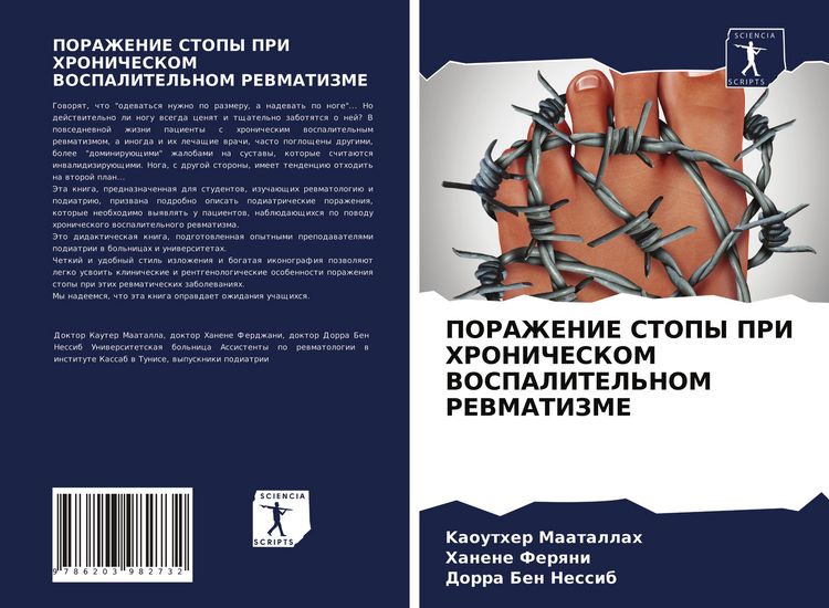 Produktbild: PORAZhENIE STOPY PRI HRONIChESKOM VOSPALITEL'NOM REVMATIZME