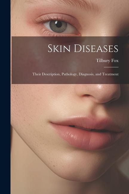 Produktbild: Skin Diseases: Their Description, Pathology, Diagnosis, and Treatment