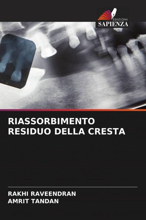 Produktbild: Riassorbimento Residuo Della Cresta