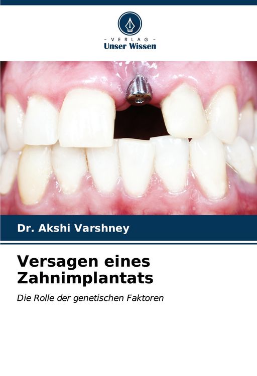 Produktbild: Versagen eines Zahnimplantats