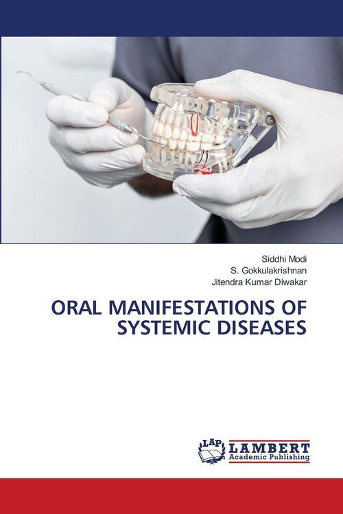 Produktbild: Oral Manifestations Of Systemic Diseases