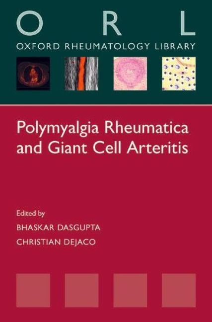 Produktbild: Polymyalgia Rheumatica and Giant Cell Arteritis