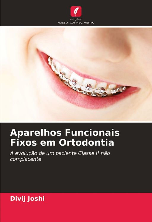 Produktbild: Aparelhos Funcionais Fixos em Ortodontia