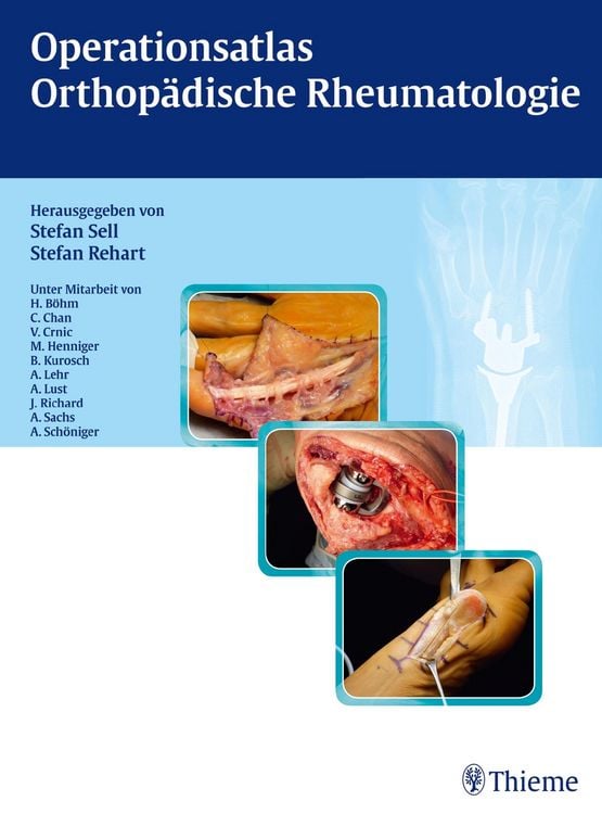 Produktbild: Operationsatlas Orthop&auml;dische Rheumatologie