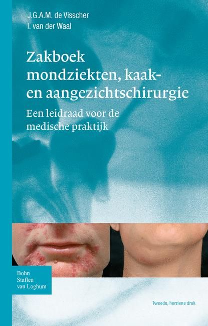 Produktbild: Zakboek mondziekten, kaak- en aangezichtschirurgie