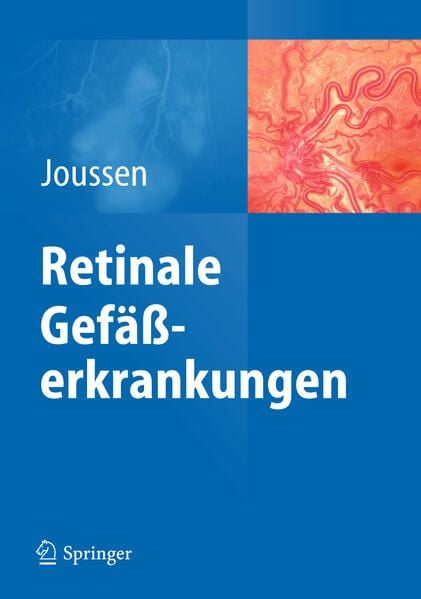 Produktbild: Retinale Gef&auml;&szlig;erkrankungen