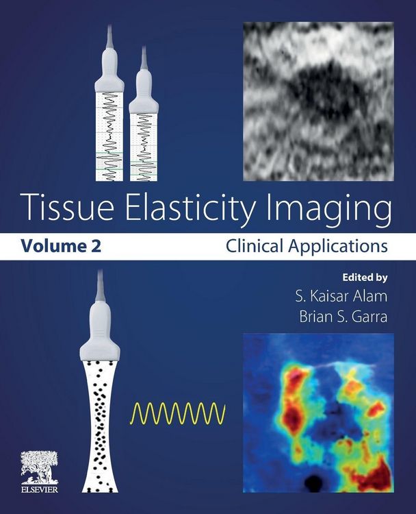 Produktbild: Tissue Elasticity Imaging