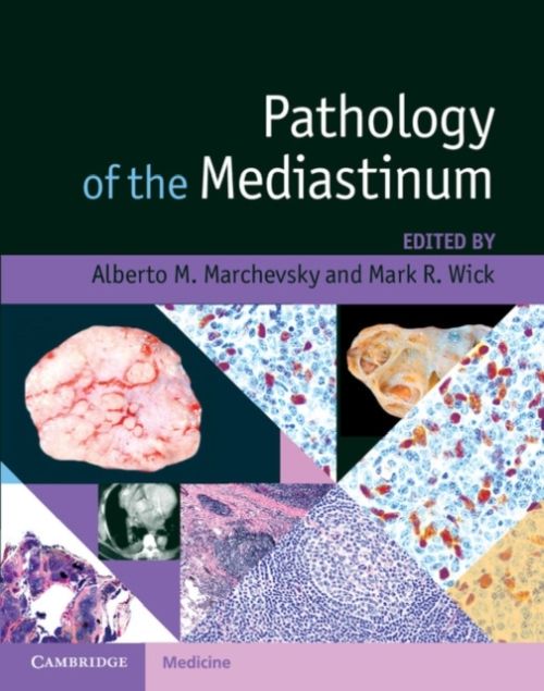 Produktbild: Pathology of the Mediastinum