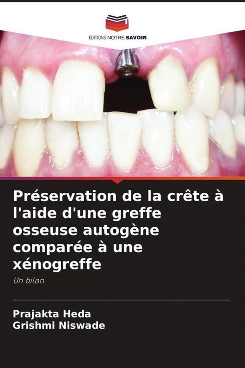 Produktbild: Pr&eacute;servation de la cr&ecirc;te &agrave; l'aide d'une greffe osseuse autog&egrave;ne compar&eacute;e &agrave; une x&eacute;nogreffe
