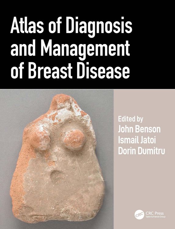 Produktbild: Atlas of Diagnosis and Management of Breast Disease