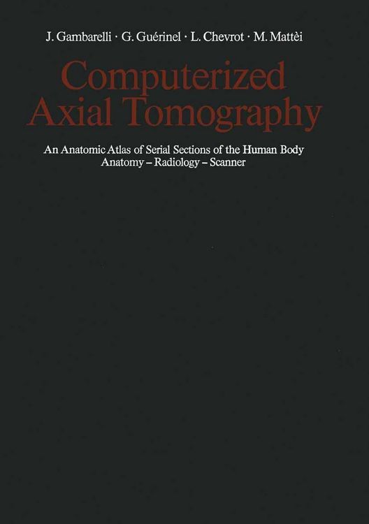Produktbild: Computerized Axial Tomography