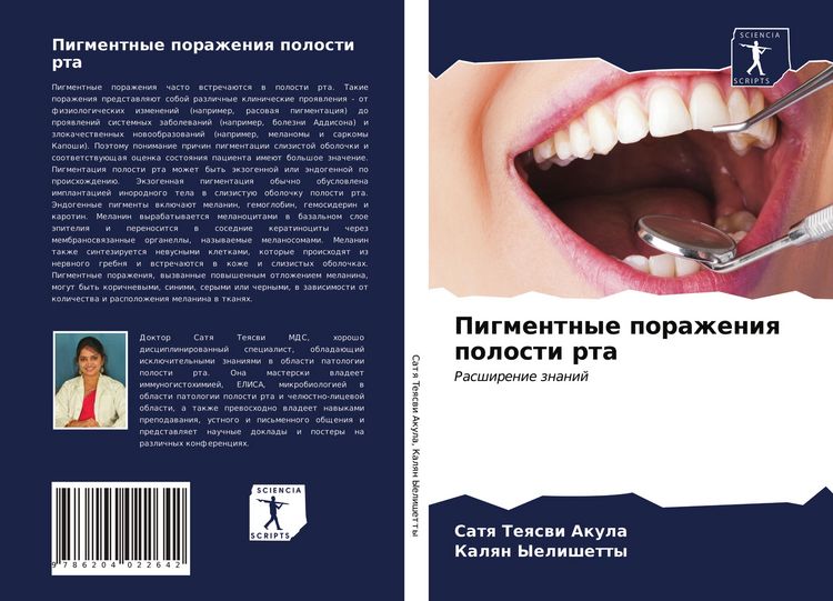 Produktbild: Pigmentnye porazheniq polosti rta