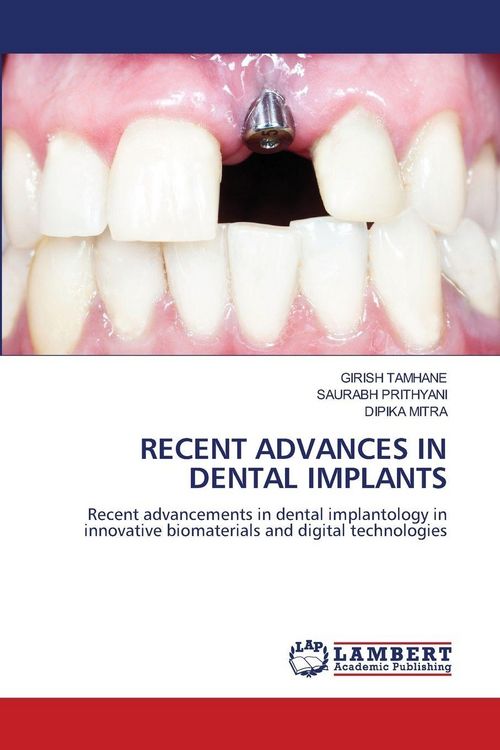 Produktbild: Recent Advances in Dental Implants