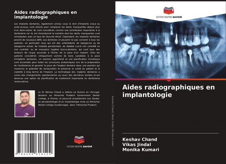 Produktbild: Aides radiographiques en implantologie