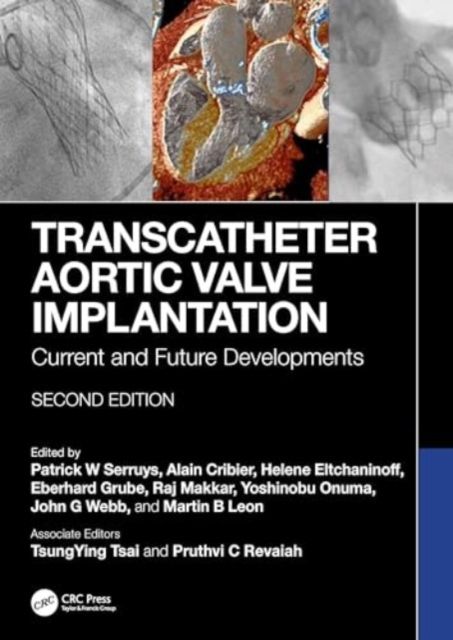 Produktbild: Transcatheter Aortic Valve Implantation