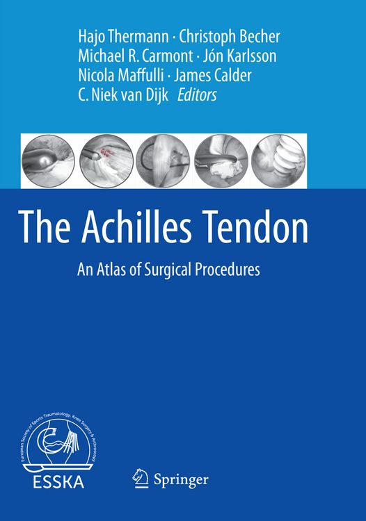 Produktbild: The Achilles Tendon