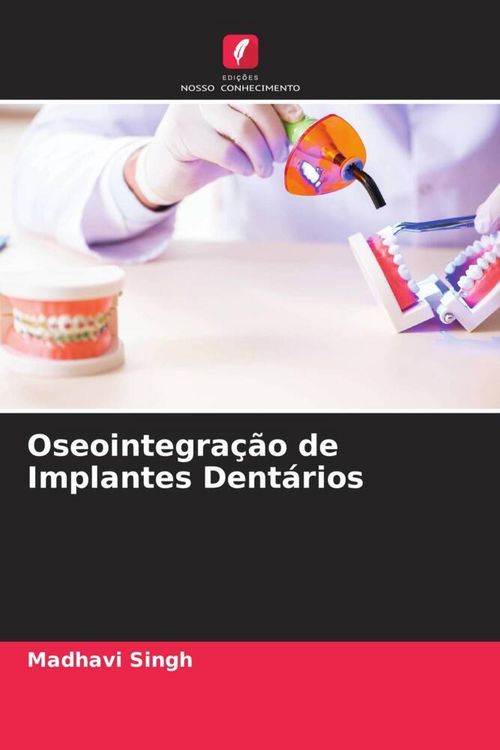 Produktbild: Oseointegra&ccedil;&atilde;o de Implantes Dent&aacute;rios