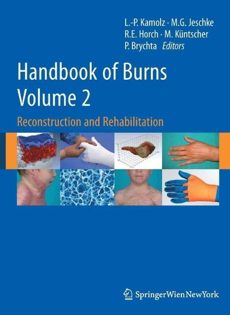 Produktbild: Handbook of Burns Volume 2