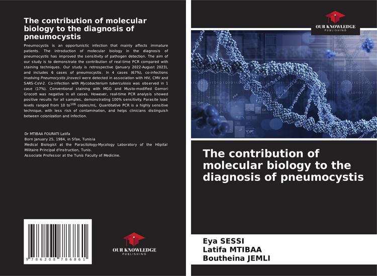 Produktbild: The contribution of molecular biology to the diagnosis of pneumocystis