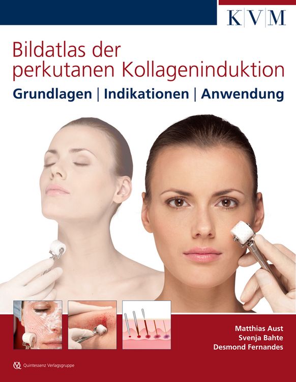 Produktbild: Bildatlas der perkutanen Kollageninduktion