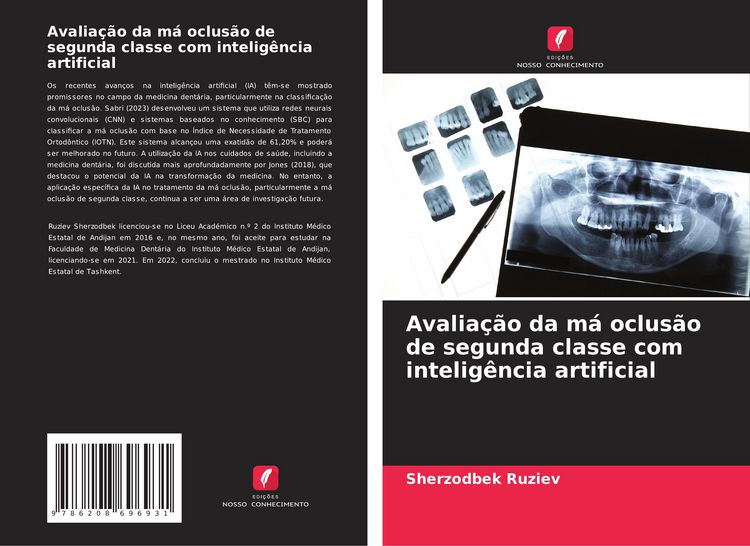 Produktbild: Avalia&ccedil;&atilde;o da m&aacute; oclus&atilde;o de segunda classe com intelig&ecirc;ncia artificial