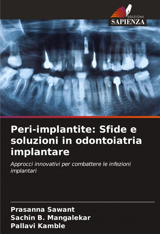 Produktbild: Peri-implantite: Sfide e soluzioni in odontoiatria implantare