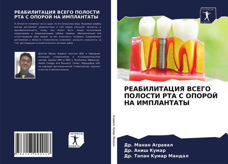 Produktbild: Reabilitaciya Vsego Polosti Rta S Oporoj Na Implantaty