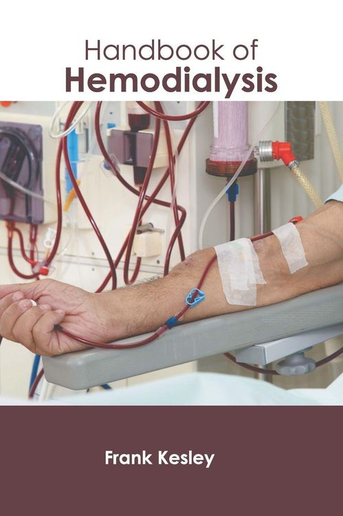 Produktbild: Handbook of Hemodialysis