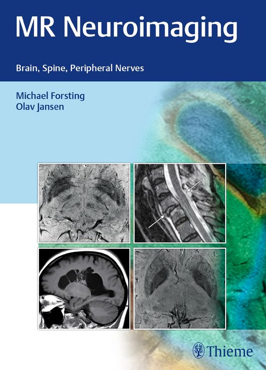 Produktbild: MR Neuroimaging