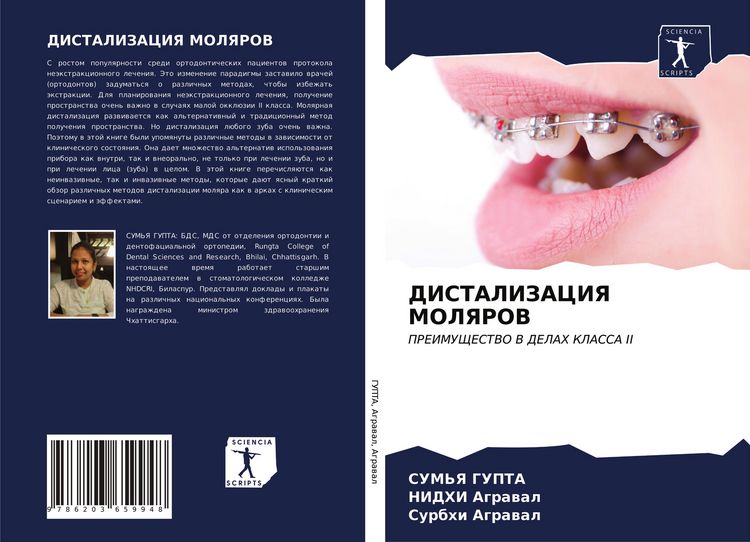 Produktbild: DISTALIZACIYa MOLYaROV