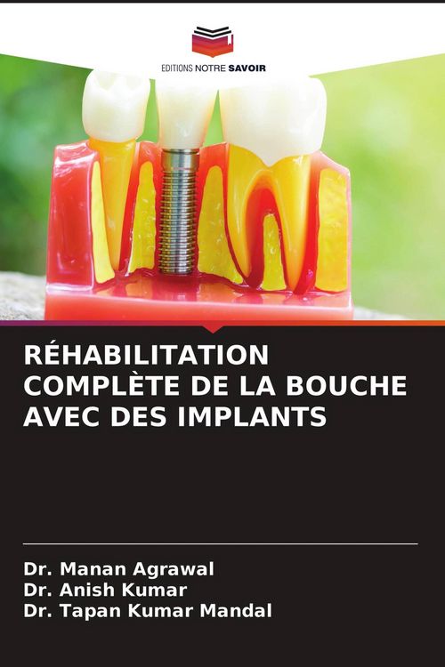 Produktbild: R&eacute;habilitation Compl&egrave;te De La Bouche Avec des Implants
