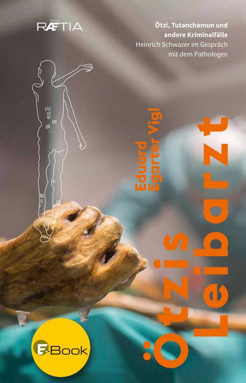 Produktbild: &Ouml;tzis Leibarzt