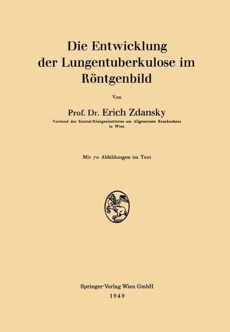 Produktbild: Die Entwicklung der Lungentuberkulose im R&ouml;ntgenbild