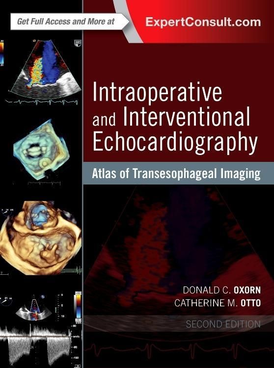 Produktbild: Intraoperative and Interventional Echocardiography