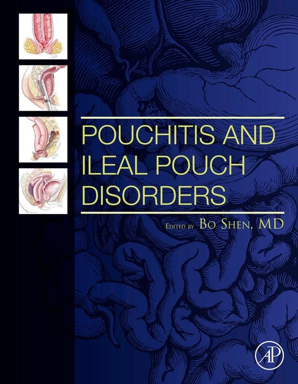 Produktbild: Pouchitis and Ileal Pouch Disorders