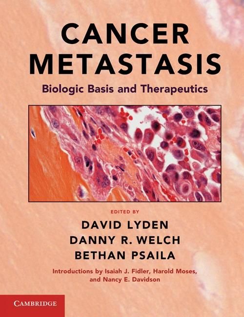 Produktbild: Cancer Metastasis