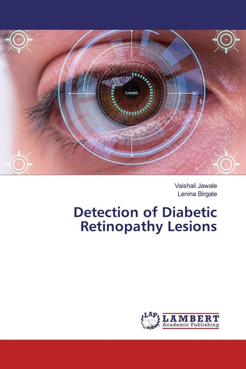 Produktbild: Detection of Diabetic Retinopathy Lesions