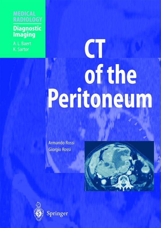 Produktbild: CT of the Peritoneum